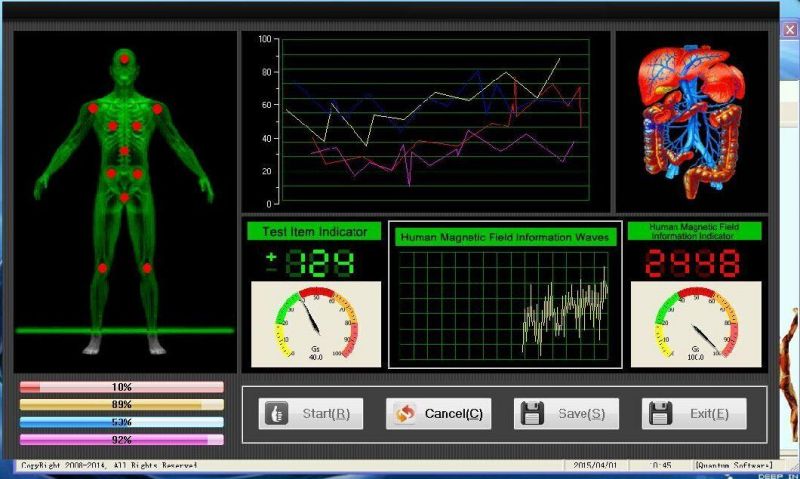 2018 Latest Mini Quantum Resonance Magnetic Analyzer Mslhq301