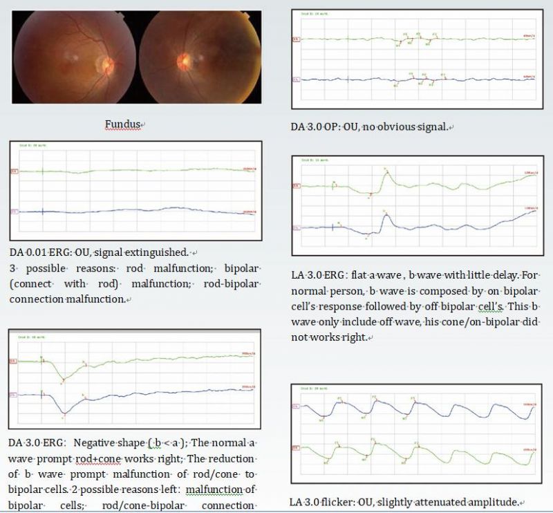 Ret-C China Top Quality Ophthalmic Equipment Muli-Focal Visual Electrophisiology